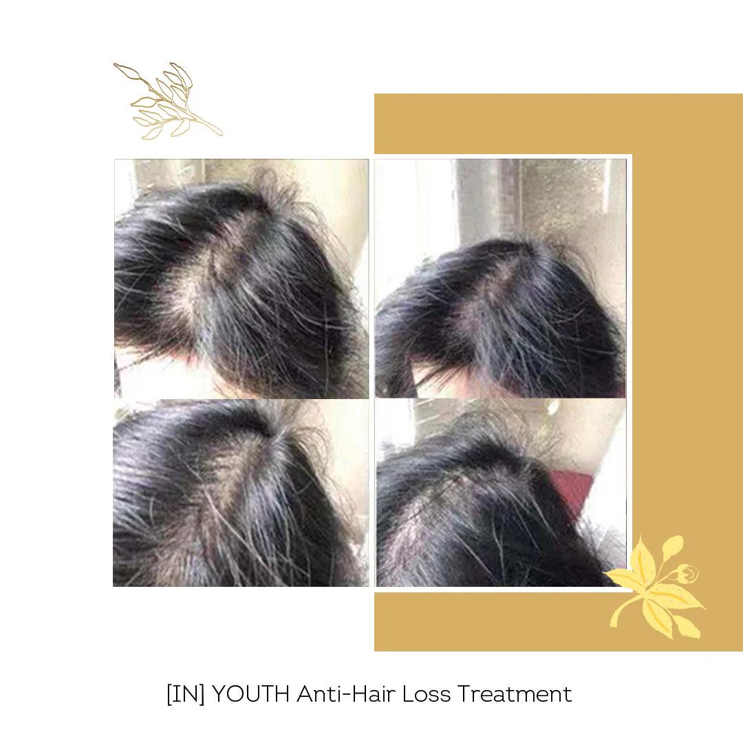 Floreve YOUTH Anti-Hair Loss Boosters 10 shots